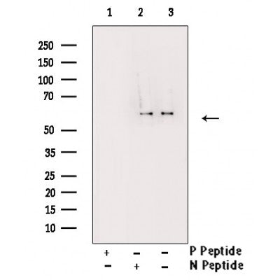 AF3253 staining HeLa by IF/ICC. The sample were fixed with PFA and permeabilized in 0.1% Triton X-100,then blocked in 10% serum for 45 minutes at 25¡ãC. The primary antibody was diluted at 1/200 and incubated with the sample for 1 hour at 37¡ãC. An  Alexa Fluor 594 conjugated goat anti-rabbit IgG (H+L) Ab, diluted at 1/600, was used as the secondary antibod