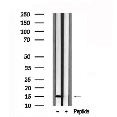 Western blot analysis of extracts of Mouse kidney  tissue sample,using Survivin Antibody(AF7614).