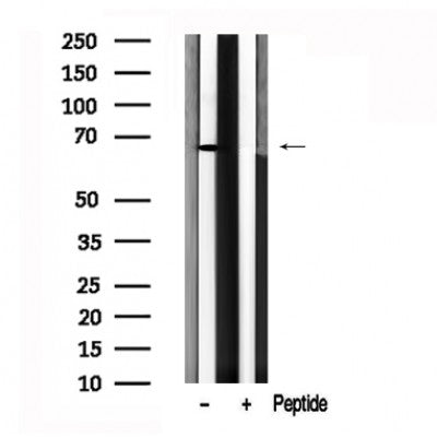 Western blot analysis of PDK1 in lysates of HepG2?, using PDK1 Antibody(AF7615).