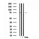 Western blot analysis of RIPK2 in lysates of 293, using RIPK2 Antibody(AF7618).