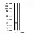 Western blot analysis of Bim in lysates of K562?, using Bim Antibody(AF7621).