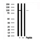 Western blot analysis of FoxO3a in lysates of Jurkat?, using FoxO3a Antibody(AF7622).