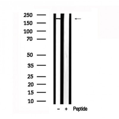 Western blot analysis of extracts of Mouse brain? tissue sample,using KIF1B Antibody(AF7629).