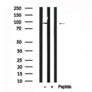 Western blot analysis of extracts of Mouse Liver   tissue sample,using TLR5 Antibody(AF7634).