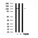 Western blot analysis of CTNND1 in lysates of HuvEc, using CTNND1 Antibody(AF7635).