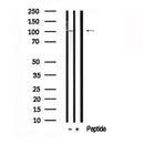 Western blot analysis of CTNND1 in lysates of HuvEc, using CTNND1 Antibody(AF7637).