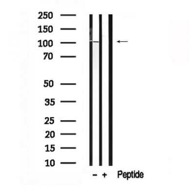 Western blot analysis of CTNND1 in lysates of HuvEc, using CTNND1 Antibody(AF7637).
