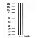 Western blot analysis of PFKFB2 in lysates of 293, using PFKFB2 Antibody(AF7638).