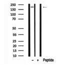 Western blot analysis of ROCK2 in lysates of HeLa?, using ROCK2 Antibody(AF7642).