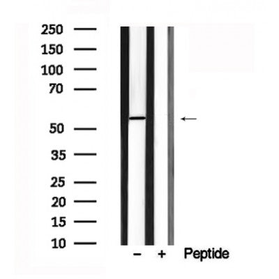 Western blot analysis of Atg13 in lysates of MCF7?, using Atg13 Antibody(AF7644).