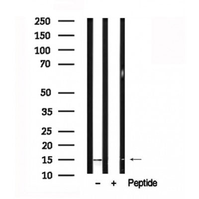 Western blot analysis of VAMP4 in lysates of K562?, using VAMP4 Antibody(AF7645).
