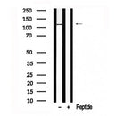 Western blot analysis of IRE1 in lysates of K562?, using IRE1 Antibody(AF7651).