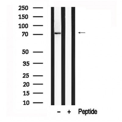 Western blot analysis of DR6 in lysates of A549?, using DR6 Antibody(AF7652).
