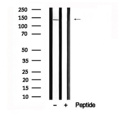 Western blot analysis of SF3B1 in lysates of fetal thymus, using SF3B1 Antibody(AF7653).