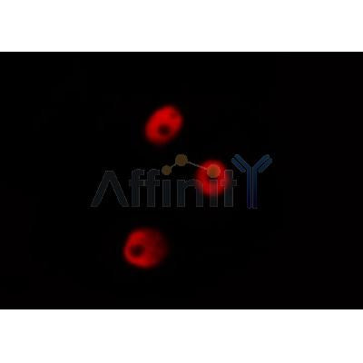 AF0226 staining HeLa by IF/ICC. The sample were fixed with PFA and permeabilized in 0.1% Triton X-100,then blocked in 10% serum for 45 minutes at 25¡ãC. The primary antibody was diluted at 1/200 and incubated with the sample for 1 hour at 37¡ãC. An  Alexa Fluor 594 conjugated goat anti-rabbit IgG (H+L) Ab, diluted at 1/600, was used as the secondary antibod