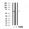 Western blot analysis of Dab1 in lysates of HeLa?, using Dab1 Antibody(AF7654).