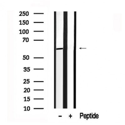 Western blot analysis of Dab1 in lysates of HeLa?, using Dab1 Antibody(AF7654).