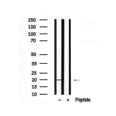 Western blot analysis of CRYAB in lysates of HepG2  , using CRYAB Antibody(AF7676).