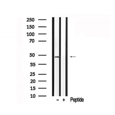 Western blot analysis of p53 in lysates of MDA-MB-435  , using p53 Antibody(AF7686).