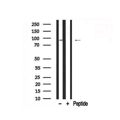 Western blot analysis of PKCB1  in lysates of HeLa  , using PKCB1 Antibody .