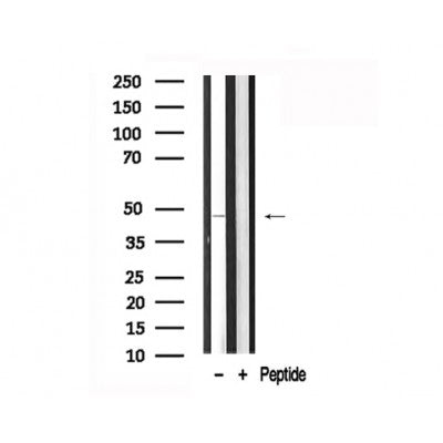 Western blot analysis of Keratin 18 in lysates of HT29, using Keratin 18 Antibody(AF7693).