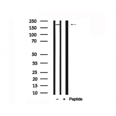 Western blot analysis of EPRS in lysates of Jurkat?, using EPRS Antibody(AF7706).
