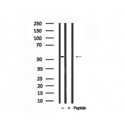 Western blot analysis of Vimentin in lysates of HeLa  , using Vimentin Antibody(AF7712).