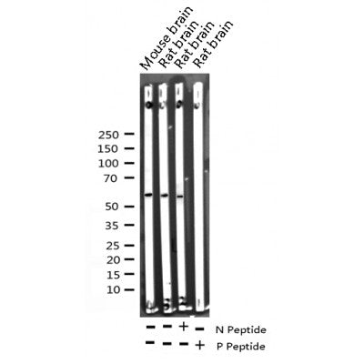 AF3263 staining HeLa by IF/ICC. The sample were fixed with PFA and permeabilized in 0.1% Triton X-100,then blocked in 10% serum for 45 minutes at 25¡ãC. The primary antibody was diluted at 1/200 and incubated with the sample for 1 hour at 37¡ãC. An  Alexa Fluor 594 conjugated goat anti-rabbit IgG (H+L) Ab, diluted at 1/600, was used as the secondary antibod