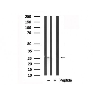 Western blot analysis of CD79A in lysates of HuvEc, using CD79A Antibody(AF7717).