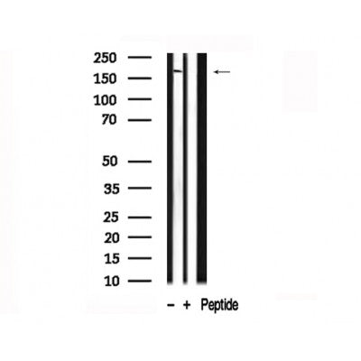 Western blot analysis of extracts of Human Lung tissue sample,using CFTR Antibody(AF7719).