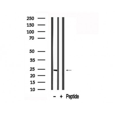 Western blot analysis of TCTP in lysates of HepG2 , using TCTP Antibody(AF7722).