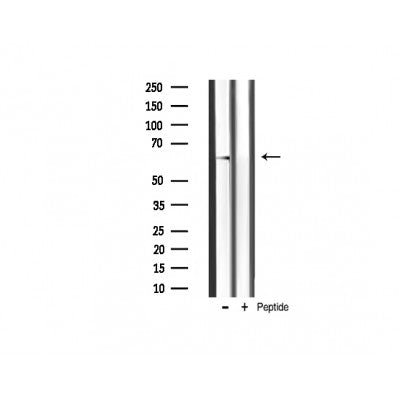 AF3264 staining A2780 by IF/ICC. The sample were fixed with PFA and permeabilized in 0.1% Triton X-100,then blocked in 10% serum for 45 minutes at 25¡ãC. The primary antibody was diluted at 1/200 and incubated with the sample for 1 hour at 37¡ãC. An  Alexa Fluor 594 conjugated goat anti-rabbit IgG (H+L) Ab, diluted at 1/600, was used as the secondary antibod