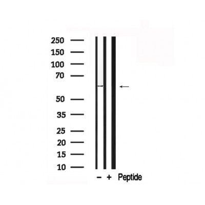 Western blot analysis of PKM2 in lysates of Jurkat?, using PKM2 Antibody(AF7731).