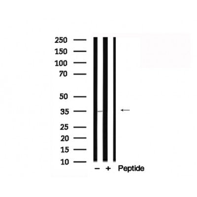 Western blot analysis of C/EBPbeta in lysates of HepG2  , using C/EBPbeta Antibody(AF7747).