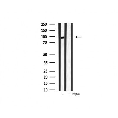 AF3267 staining SW626 by IF/ICC. The sample were fixed with PFA and permeabilized in 0.1% Triton X-100,then blocked in 10% serum for 45 minutes at 25¡ãC. The primary antibody was diluted at 1/200 and incubated with the sample for 1 hour at 37¡ãC. An  Alexa Fluor 594 conjugated goat anti-rabbit IgG (H+L) Ab, diluted at 1/600, was used as the secondary antibod