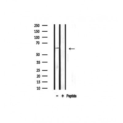 Western blot analysis on mouse brain lysate using Osteopontin Antibody