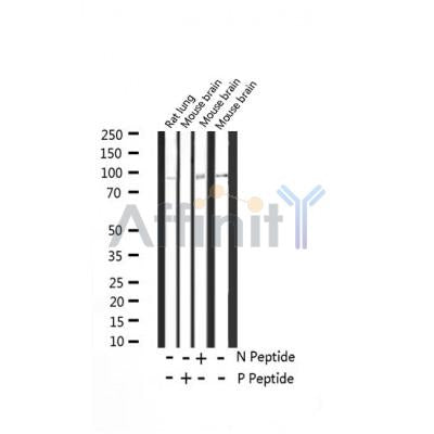 AF3268 staining SW626 by IF/ICC. The sample were fixed with PFA and permeabilized in 0.1% Triton X-100,then blocked in 10% serum for 45 minutes at 25¡ãC. The primary antibody was diluted at 1/200 and incubated with the sample for 1 hour at 37¡ãC. An  Alexa Fluor 594 conjugated goat anti-rabbit IgG (H+L) Ab, diluted at 1/600, was used as the secondary antibod