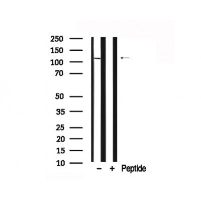 Western blot analysis of c-Cbl in lysates of HeLa , using c-Cbl Antibody(AF7764).