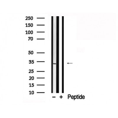 Western blot analysis of extracts of mouse brain tissue sample,using MARCKS Antibody(AF7790).