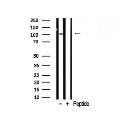 Western blot analysis of CTNNA1 in lysates of HeLa?, using CTNNA1 Antibody(AF7795).