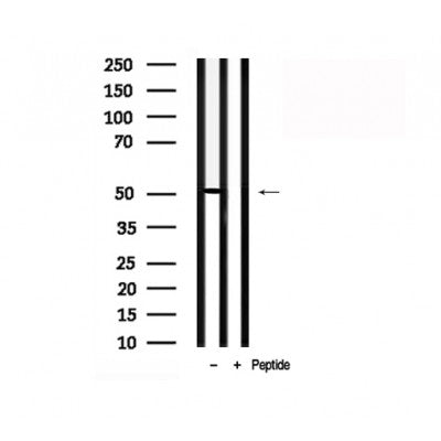 Western blot analysis of  -Arrestin 1 in lysates of Jurkat?, using  -Arrestin 1 Antibody(AF7810).