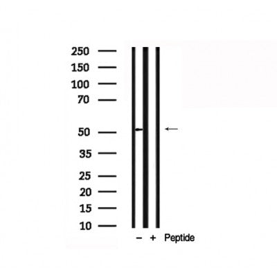 Western blot analysis of GSK3 alpha in lysates of ovary cancer, using GSK3 alpha Antibody(AF7813).