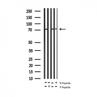 AF3276 staining HeLa by IF/ICC. The sample were fixed with PFA and permeabilized in 0.1% Triton X-100,then blocked in 10% serum for 45 minutes at 25¡ãC. The primary antibody was diluted at 1/200 and incubated with the sample for 1 hour at 37¡ãC. An  Alexa Fluor 594 conjugated goat anti-rabbit IgG (H+L) Ab, diluted at 1/600, was used as the secondary antibod