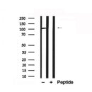 Western blot analysis of extracts of human brain? tissue sample,using PSD95 Antibody(AF7839).