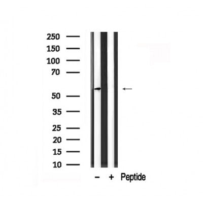 Western blot analysis of MEF2A in lysates of HeLa , using MEF2A Antibody(AF7844).