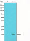 Western blot analysis on HeLa cell lysate using p16 INK Antibody. The lane on the left is treated with the antigen-specific peptide.