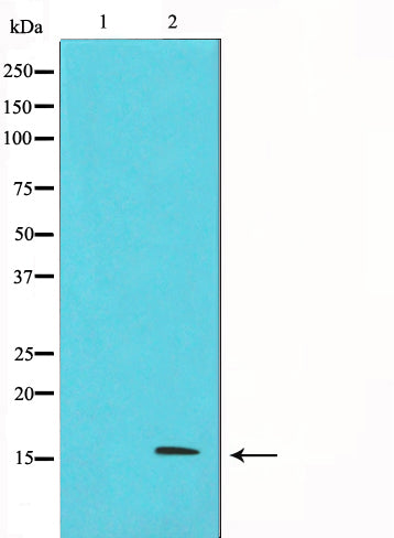 Western blot analysis on HeLa cell lysate using p16 INK Antibody. The lane on the left is treated with the antigen-specific peptide.