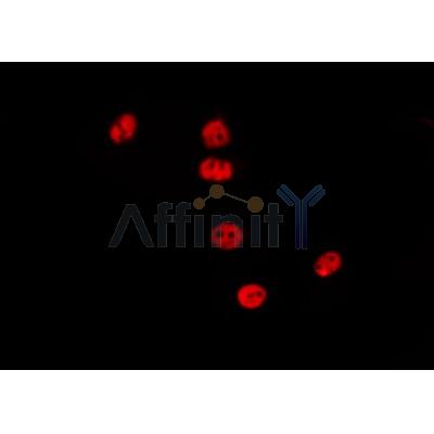 AF0228 staining LOVO by IF/ICC. The sample were fixed with PFA and permeabilized in 0.1% Triton X-100,then blocked in 10% serum for 45 minutes at 25¡ãC. The primary antibody was diluted at 1/200 and incubated with the sample for 1 hour at 37¡ãC. An  Alexa Fluor 594 conjugated goat anti-rabbit IgG (H+L) Ab, diluted at 1/600, was used as the secondary antibod