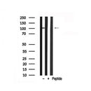 Western blot analysis of DDR1 in lysates of HepG2 , using DDR1 Antibody(AF7861).