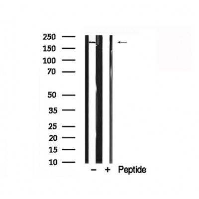 Western blot analysis of extracts of Mouse brain tissue sample,using NMDAR2A Antibody(AF7862).